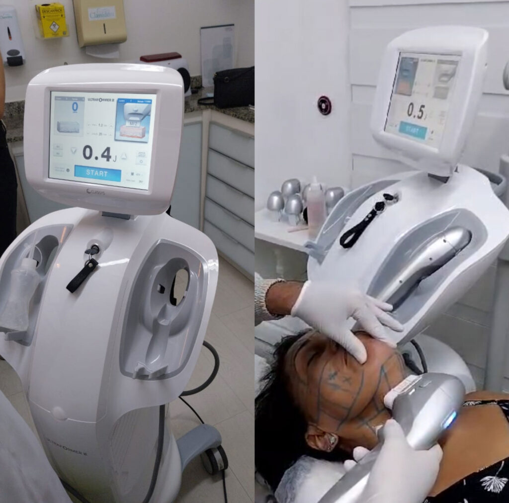 Classident Harmonização Orofacial